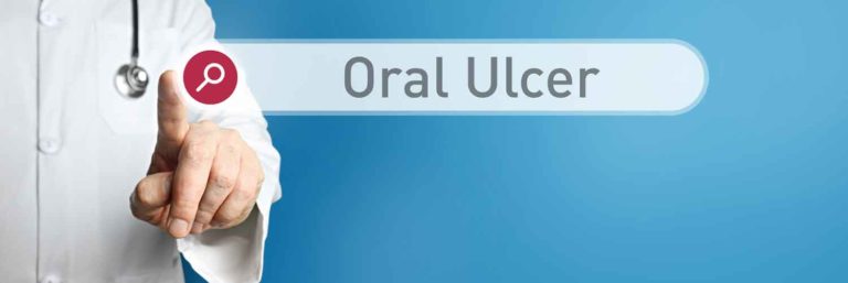 CBD Treats Oral Ulcers, According to Study