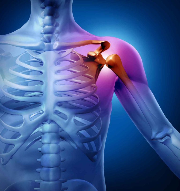 Cannabis Treats Chronic Musculoskeletal Pain, According to Study