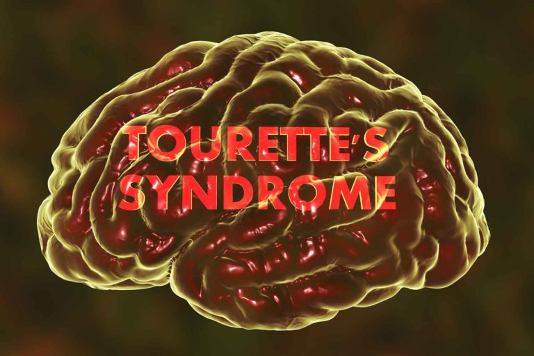 THC Effective in Patients with Tourette’s Syndrome, According to Study
